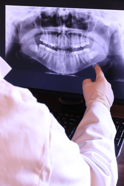 Best Knocked-Out Tooth (Avulsed Tooth) Treatment in Redkey, IN